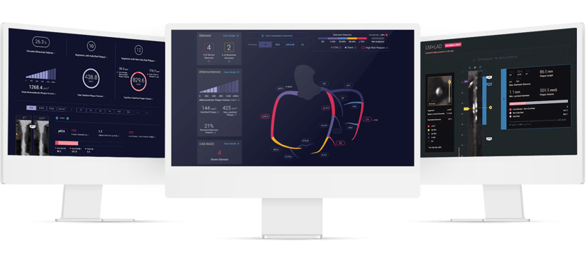 three-monitor-cleerly-product-shot-revised-101524