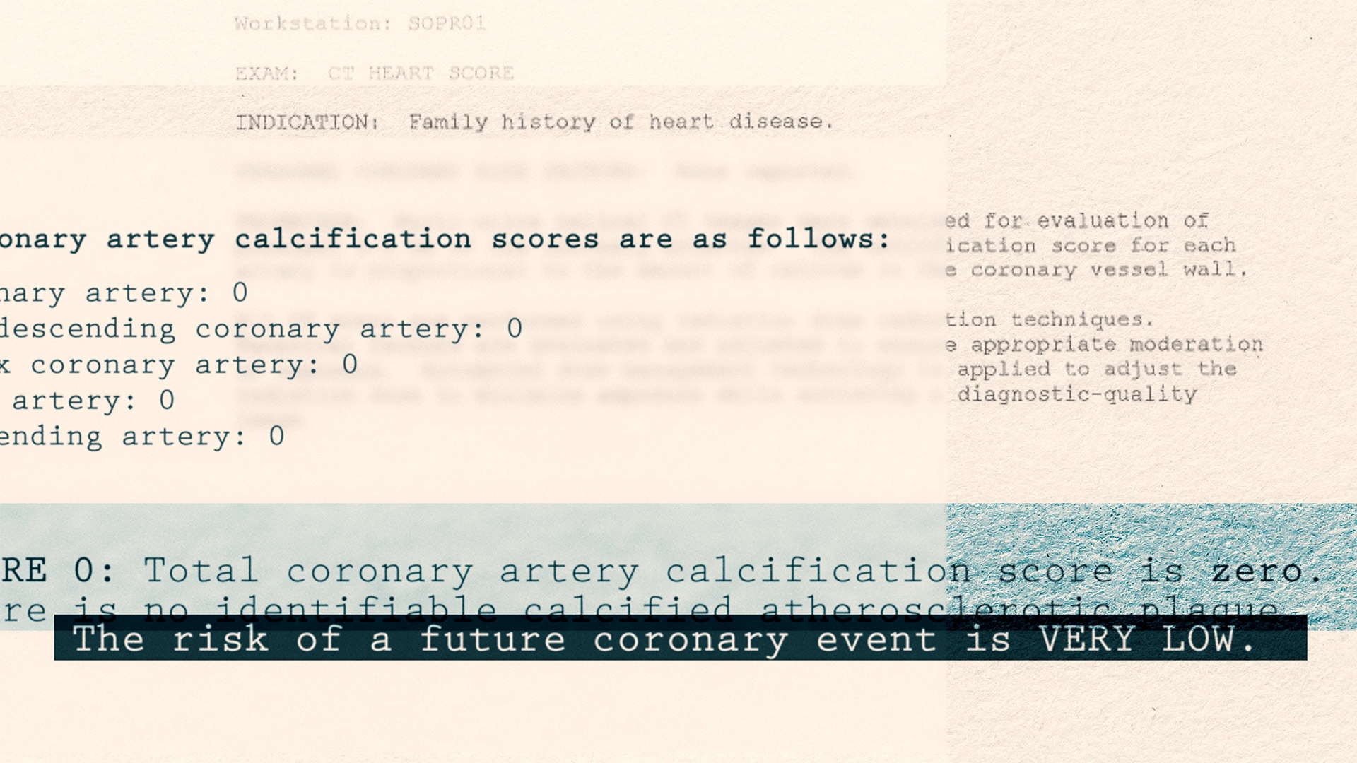 Sharon Bruno - Zero Calcium Score